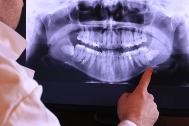 Best Broken or Chipped Tooth Repair in Mowbray Mountain, TN