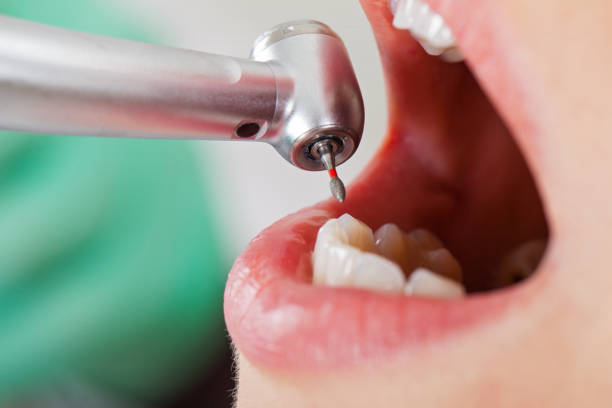 Best Emergency Cosmetic Dentistry (e.g., broken veneers) in Mowbray Mountain, TN